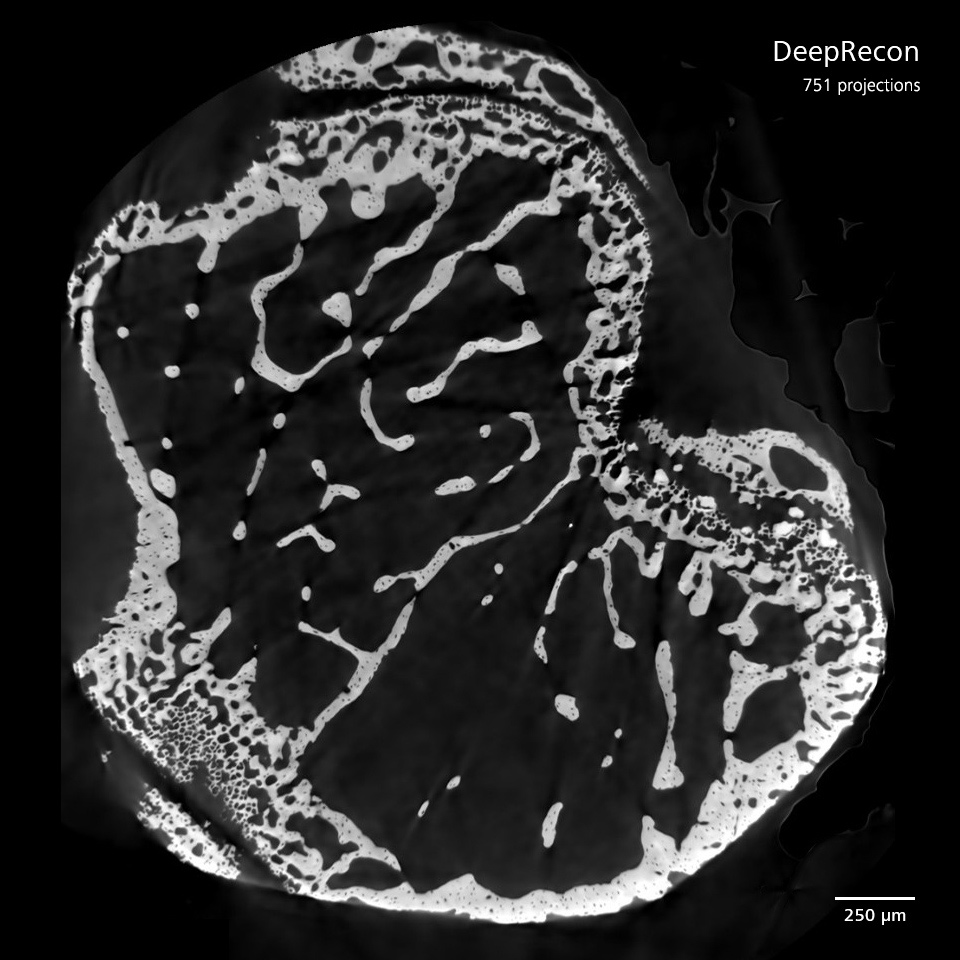 マウス皮質骨、ZEISS Xradia Versaでイメージング、751投影像をDeepReconにより再構築。