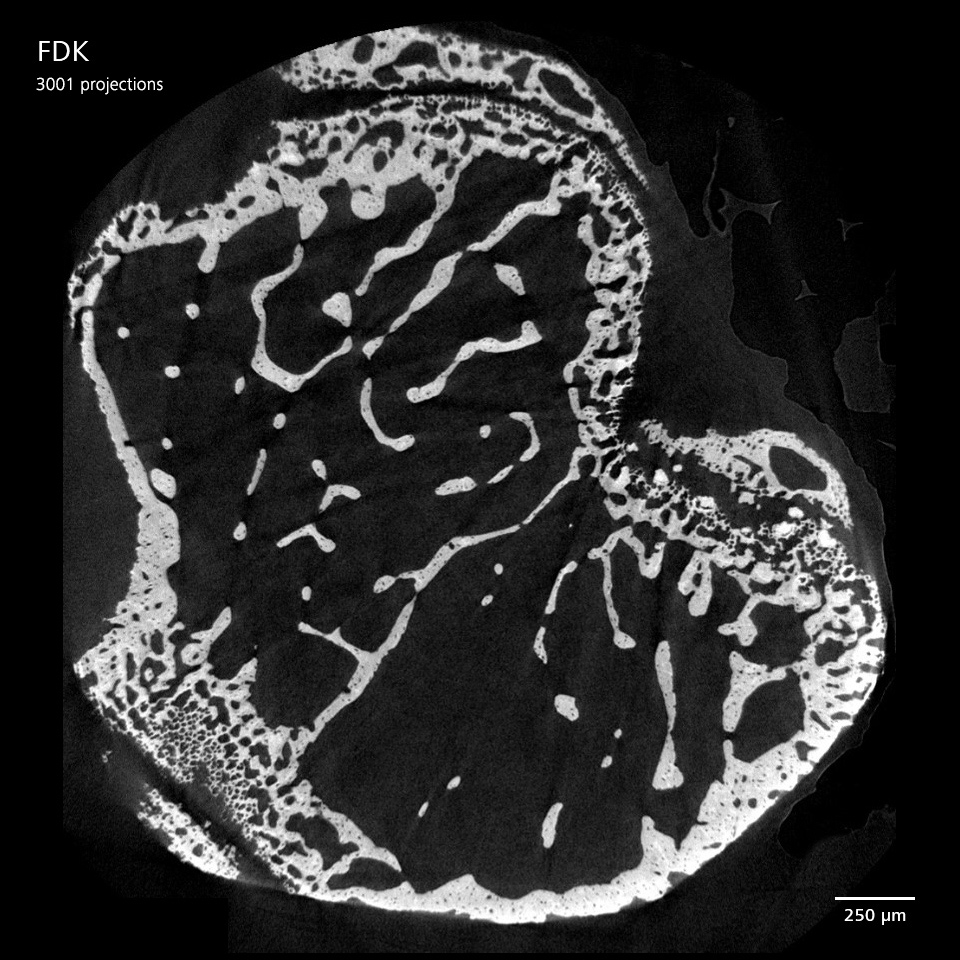 Image d'un os cortical de souris capturée avec ZEISS Xradia Versa, reconstruit à l'aide de FDK avec 3001 projections