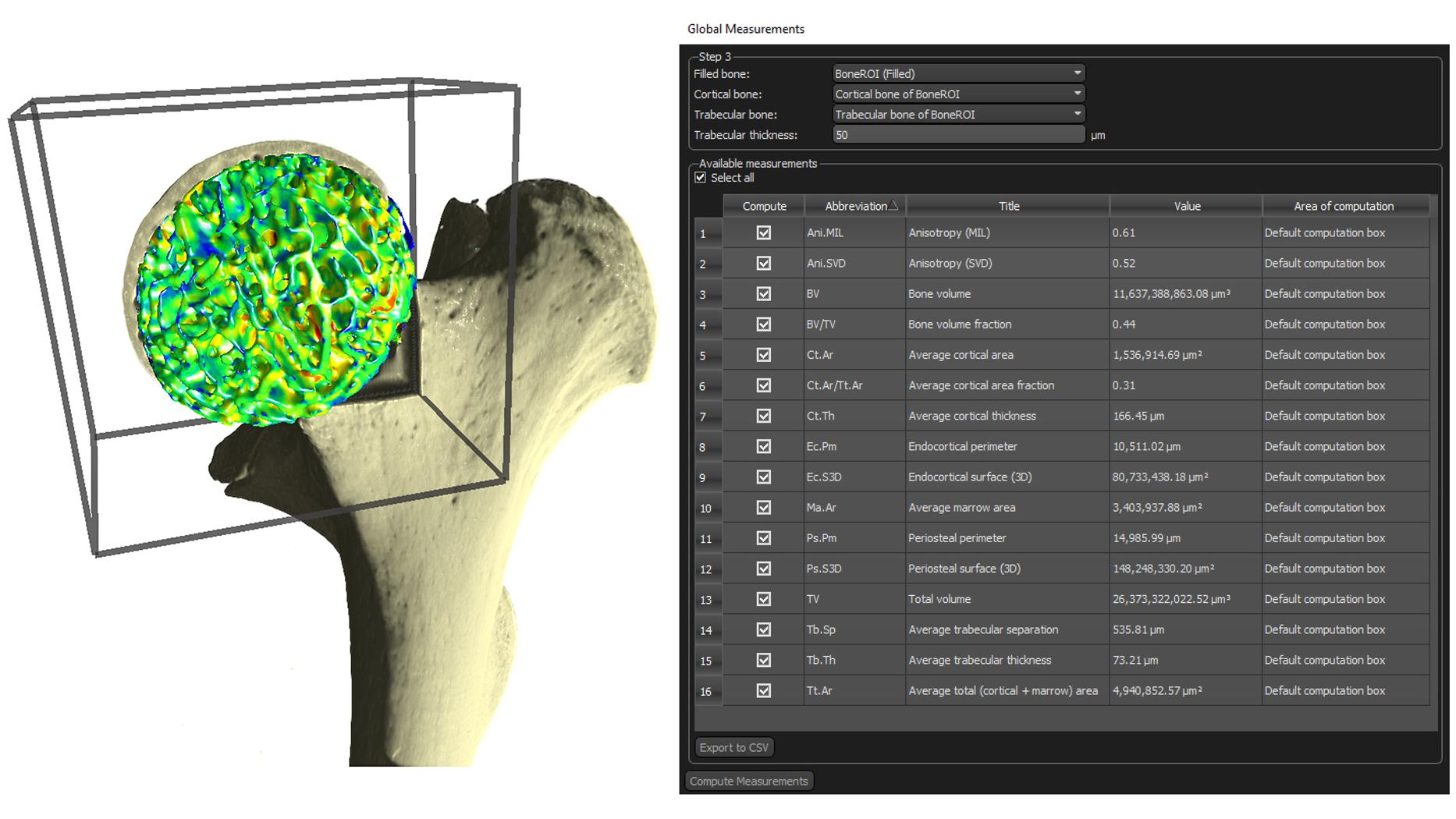 Mouse long bone segmented and analyzed to generate some of the standard quantifiable measures for bone