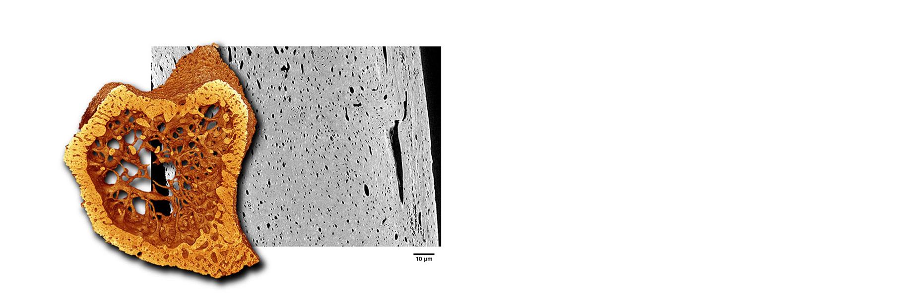 Mouse tibia imaged using ZEISS Xradia Context microCT​