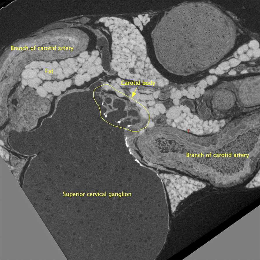 Corte en 2D de un conjunto de datos de XRM en 3D, preparado para el SEM de caras de bloques en serie. Cortesía de Alana Burrell @EM_STP, Instituto CRICK, Reino Unido