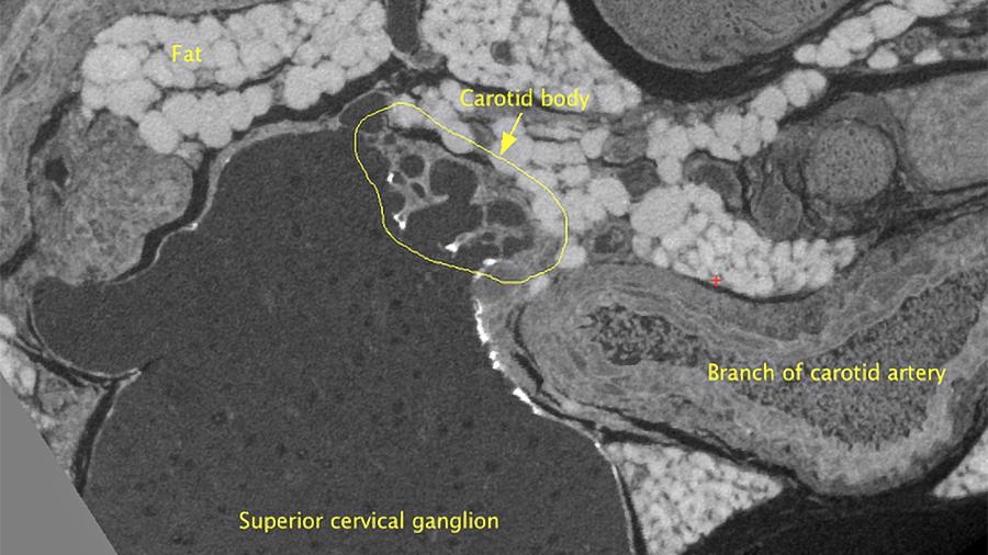 2D‑Schnitt erstellt aus einem 3D-XRM-Datensatz, vorbereitet für Serial-Blockface-SEM. Mit freundlicher Genehmigung von Alana Burrell @EM_STP, CRICK Institute, UK​