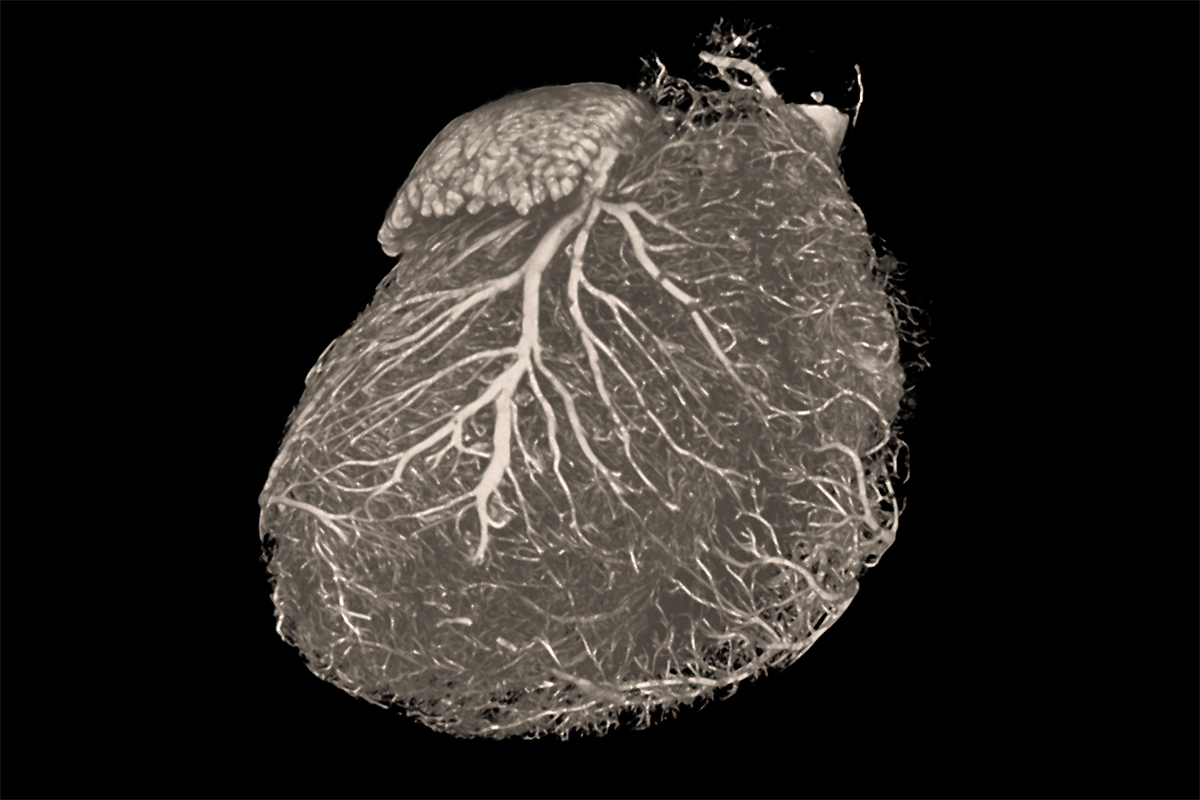 Image d'un cœur de rat capturée à l'aide du microscope à rayons X ZEISS Xradia Versa.  Échantillon avec l'aimable autorisation de Lara Konijnenberg et Anat Akiva, Centre médical de l'Université Radboud, Pays-Bas.