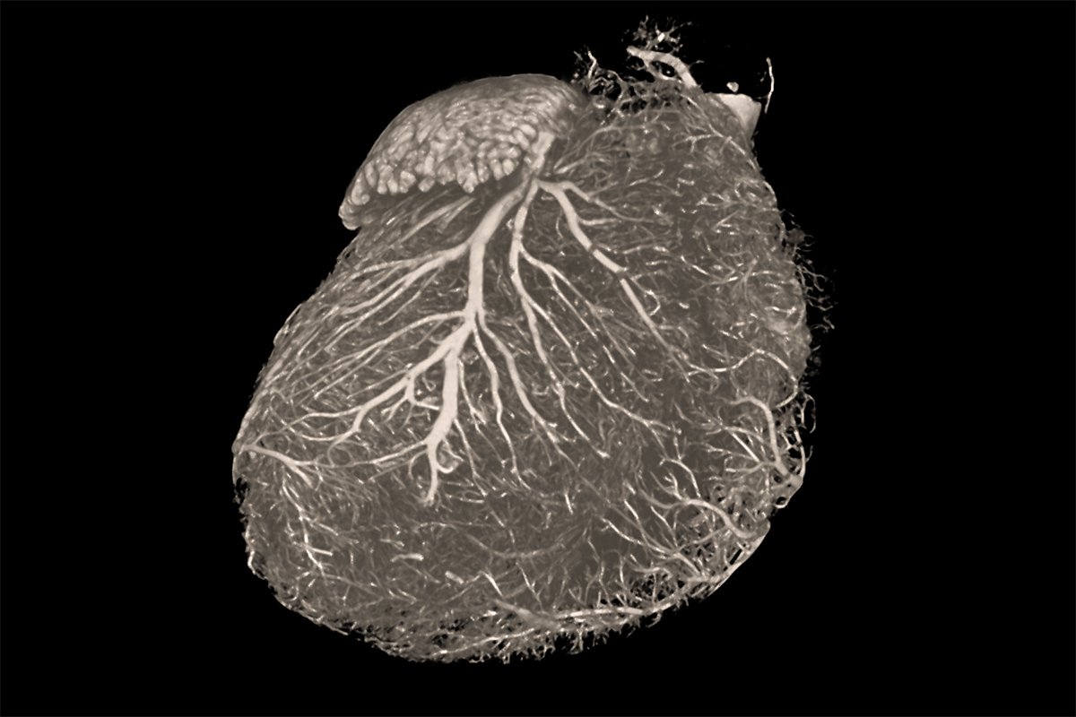 Corazón de ratón captado con el microscopio de rayos X ZEISS Xradia Versa. 