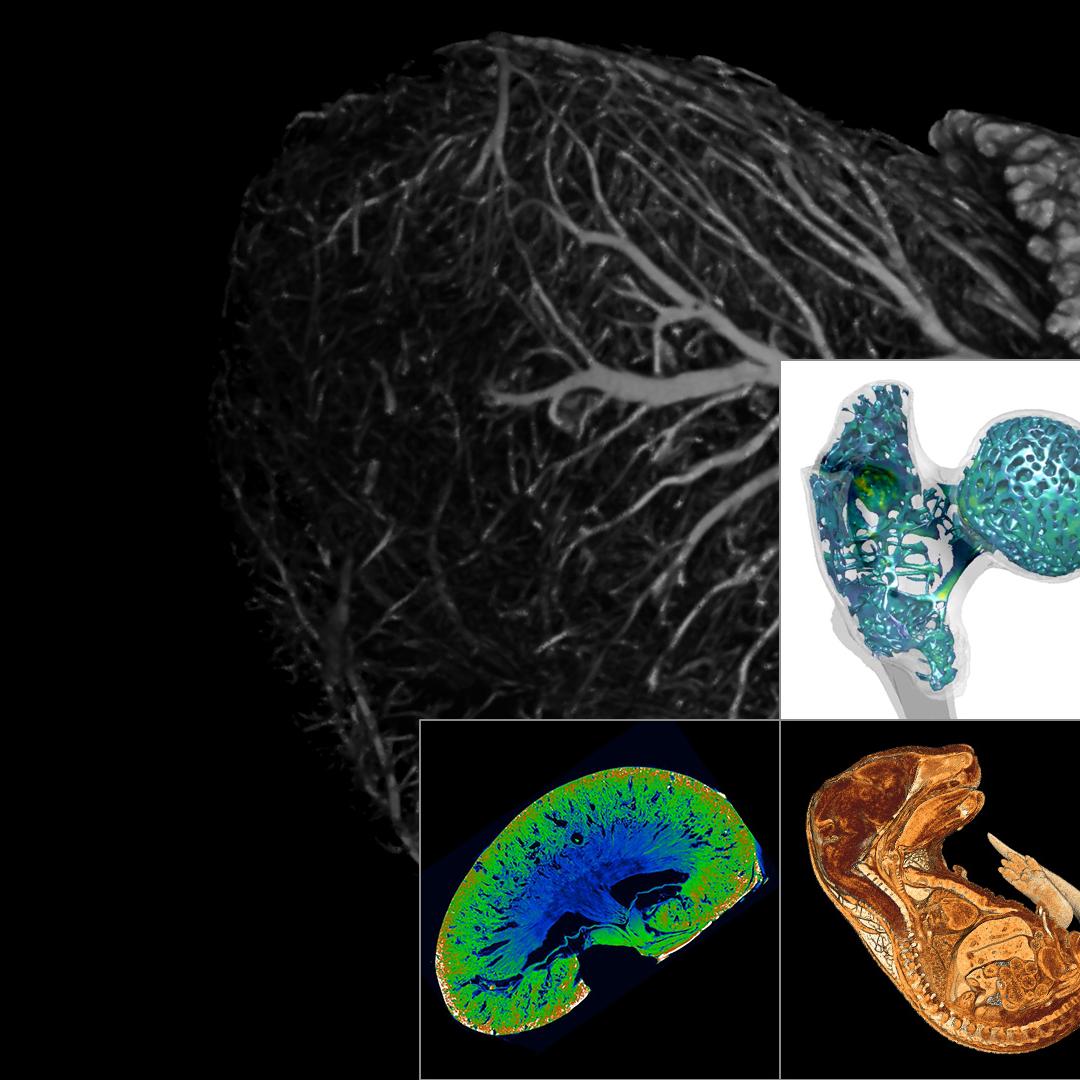x-ray-microscopy-life-science.jpg