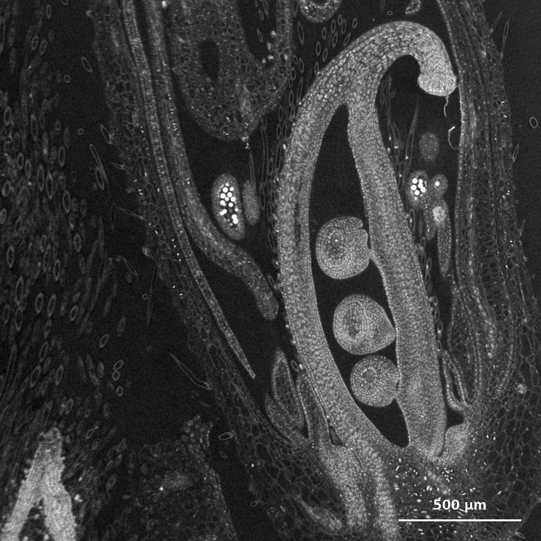 Complejo floral en desarrollo de soja, captado con el microscopio de rayos X ZEISS Xradia Versa, se ve el ovario con los óvulos en desarrollo rodeados por las anteras que contienen brillantes granos de polen.