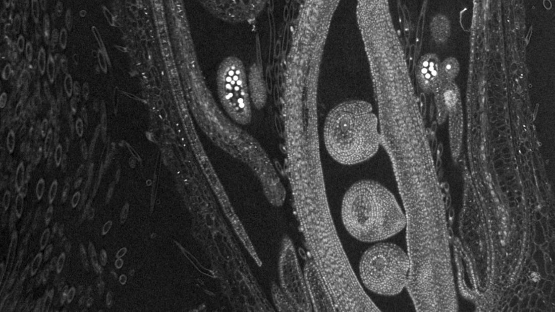 Sich entwickelndes Blütenorgan einer Sojabohne, aufgenommen mit ZEISS Xradia Versa-Röntgenmikroskop. Zeigt den Fruchtknoten mit sich entwickelnder Samenanlage, umgeben von Staubbeuteln, die mit Pollenkörnern gefüllt sind.