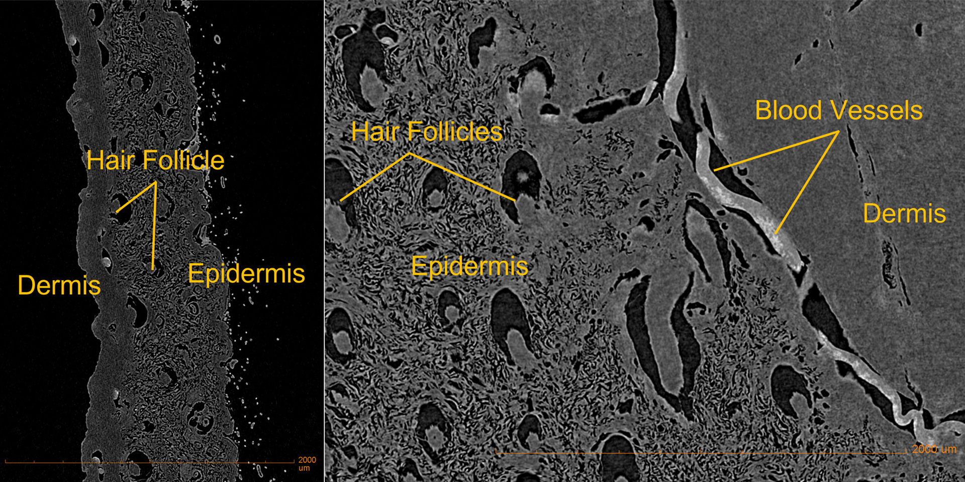 Einzelne 2D‑Projektionen eines hochauflösenden 3D‑Scans der Hautprobe einer Maus, aufgenommen mit ZEISS Xradia Versa 