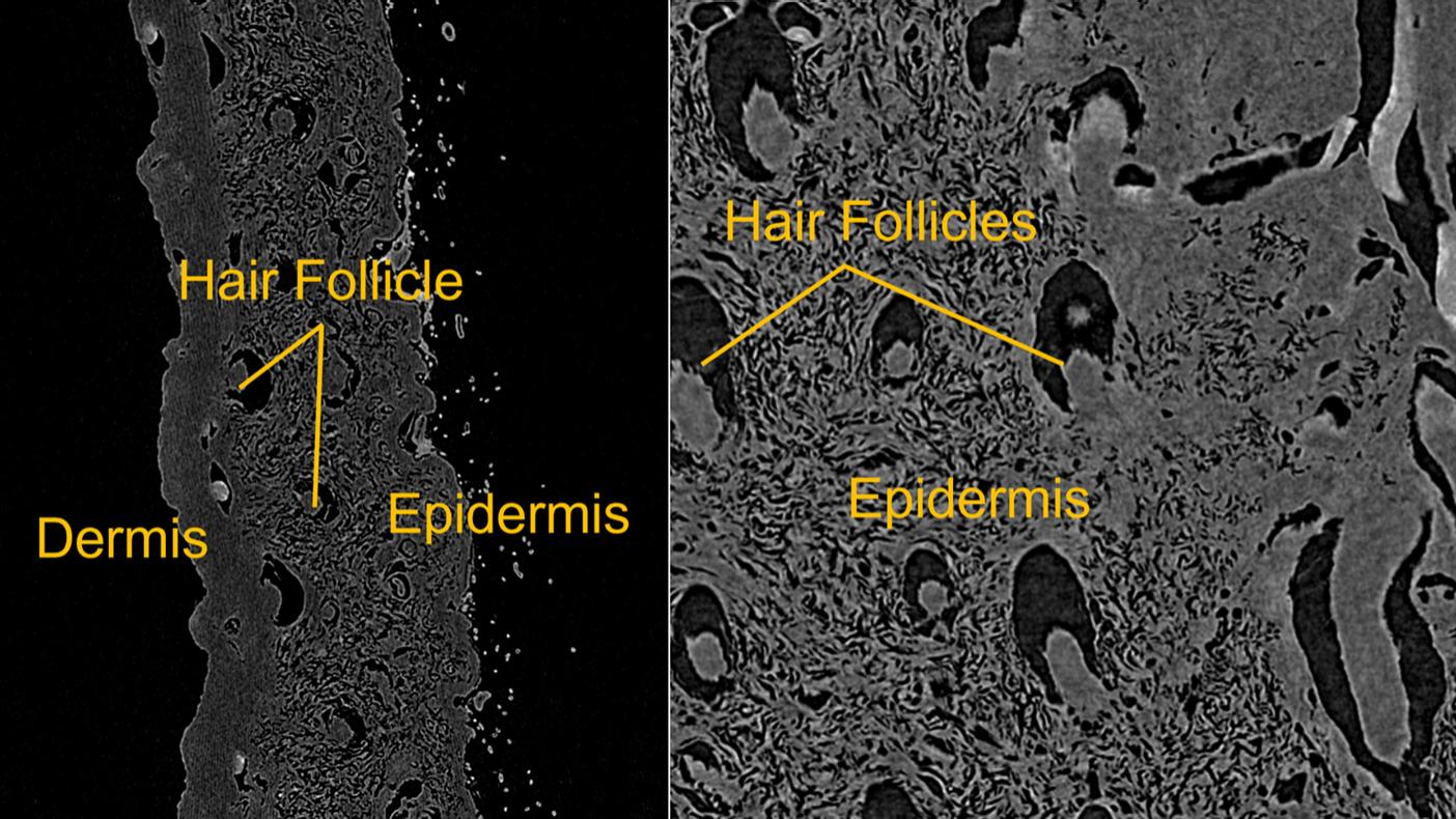 Proyecciones individuales en 2D de un escaneo en 3D de alta resolución de un fragmento de piel de ratón diseccionada captada con ZEISS Xradia Versa