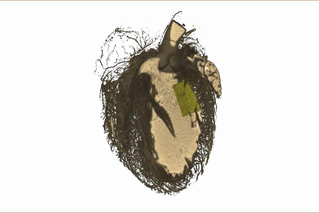 Conjunto de datos en 3D de corazón de rata de Versa XRM