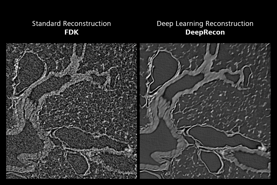 Tejido pulmonar de ratón. Secciones individuales equivalentes en 2D mediante conjuntos de datos reconstruidos, captados con los mismos parámetros (3001 imágenes de proyección). Izquierda: Reconstrucción FDK estándar. Derecha: Reconstrucción mediante aprendizaje profundo (DeepRecon).