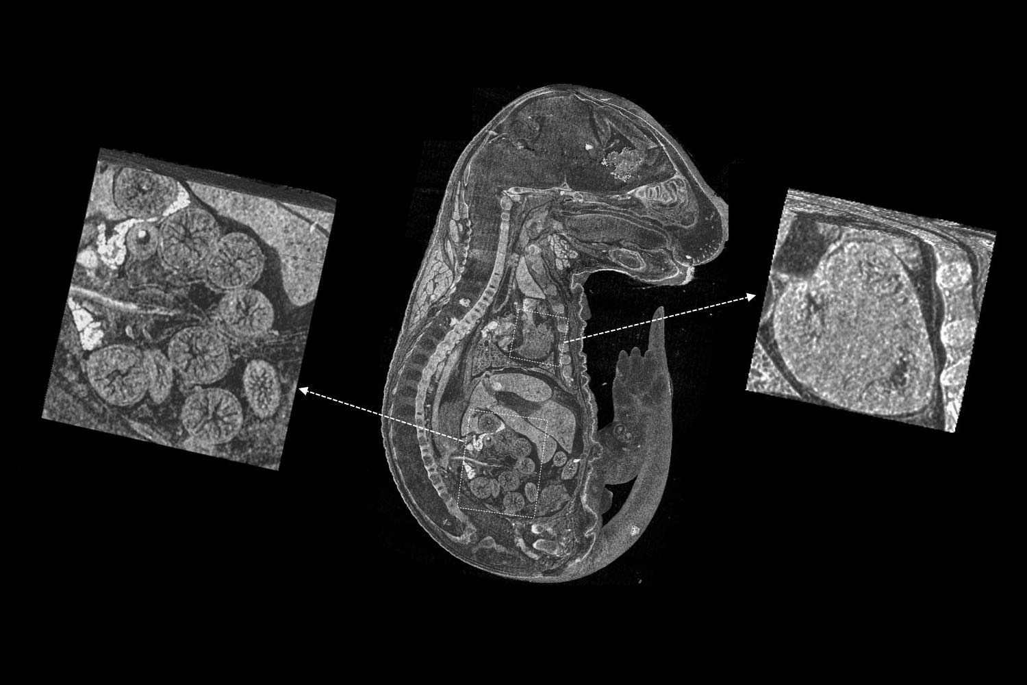 Embrión de ratón no teñido captado con ZEISS Xradia Versa con alto contraste Cortesía del Dr. Yukako Yagi, Hospital general de Massachusetts, EE. UU.