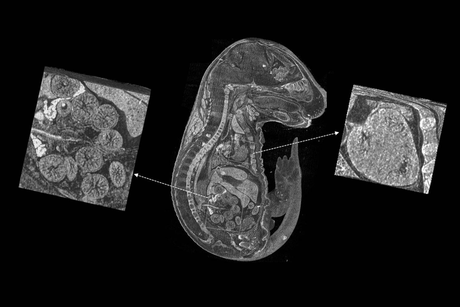 Embrión de ratón de teñido 