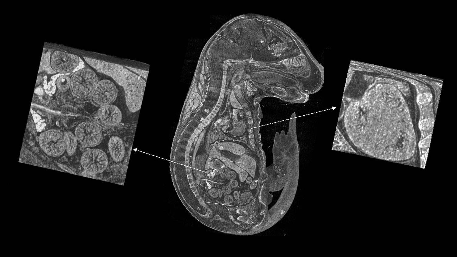 Image d'un embryon de souris non coloré capturée avec la capacité de contraste élevé de ZEISS Xradia Versa.