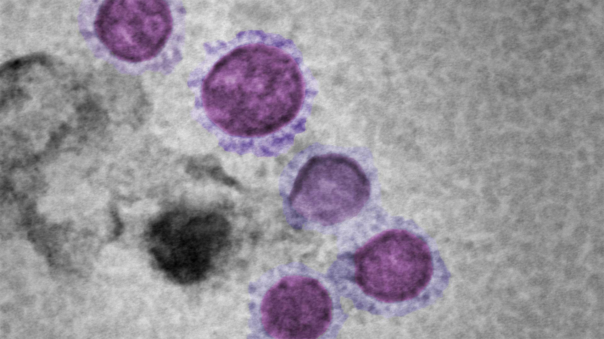 新型冠状病毒，使用蔡司GeminiSEM 560成像。由英国英格兰公共卫生局病毒参考部门的M. Hannah提供。