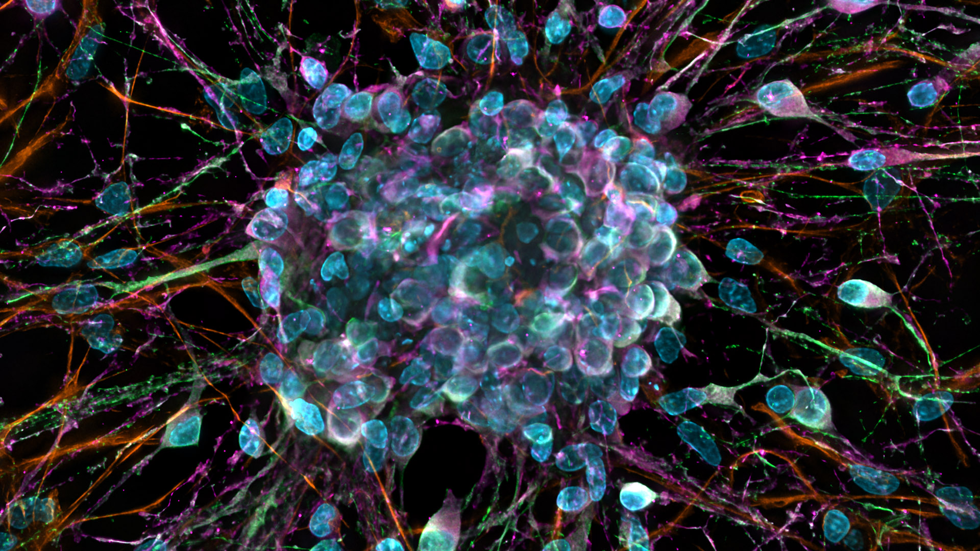 Neurospheres. Sample courtesy of H. Braun, LSM Bioanalytik GmbH, Magdeburg, Germany.