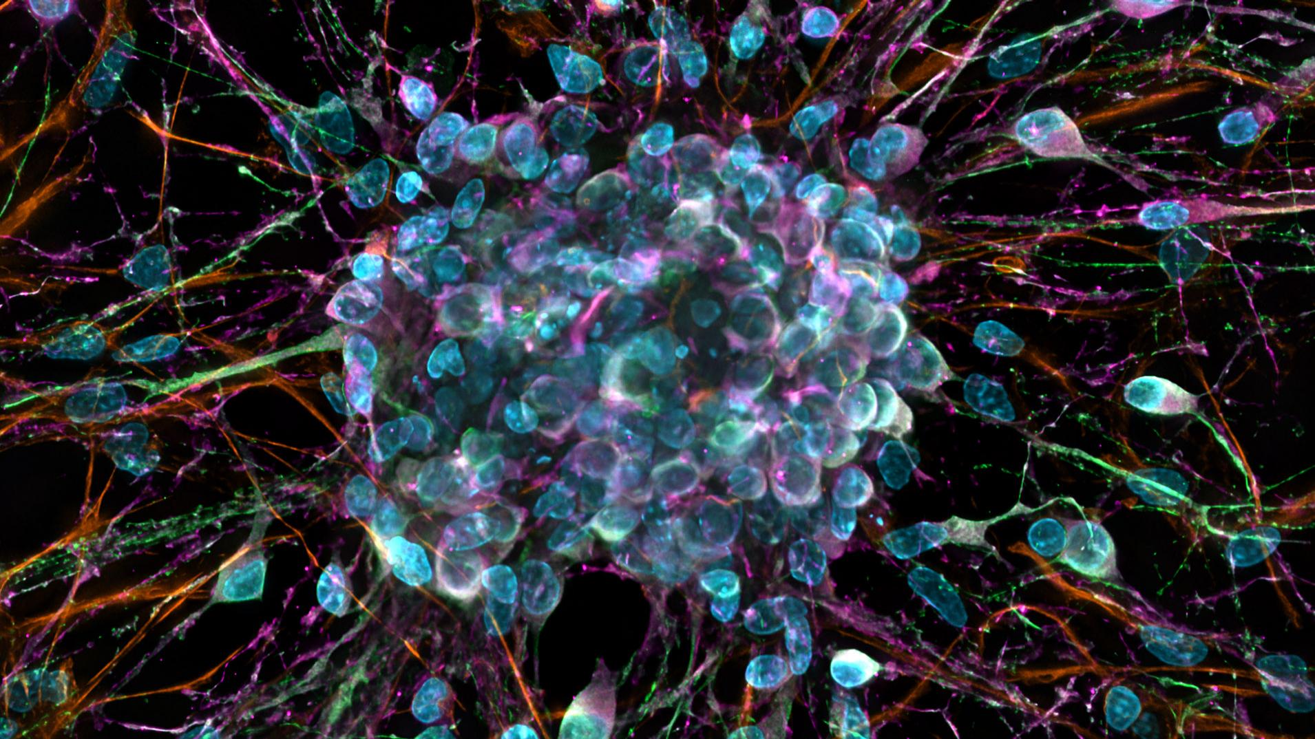 Neurospheres. Sample courtesy of H. Braun, LSM Bioanalytik GmbH, Magdeburg, Germany.