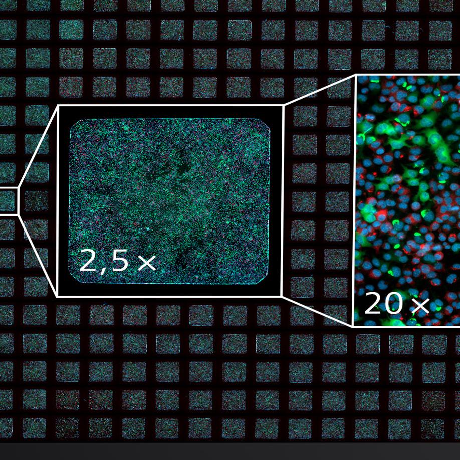 Lead Identification in Drug Discovery