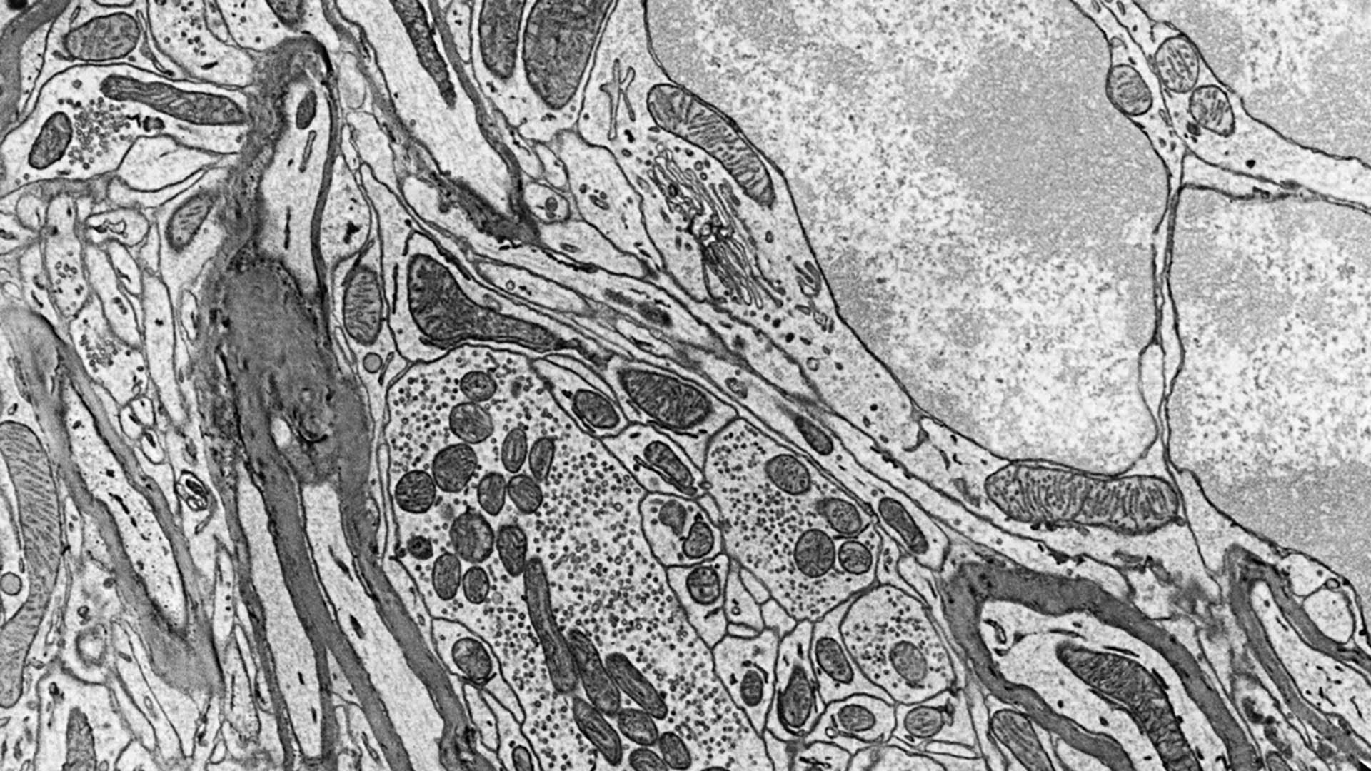 Mäusegehirn, OTO-Färbung, aufgenommen mit ZEISS GeminiSEM 300. Probe mit freundlicher Genehmigung von C. Genoud, FMI, Basel, Schweiz