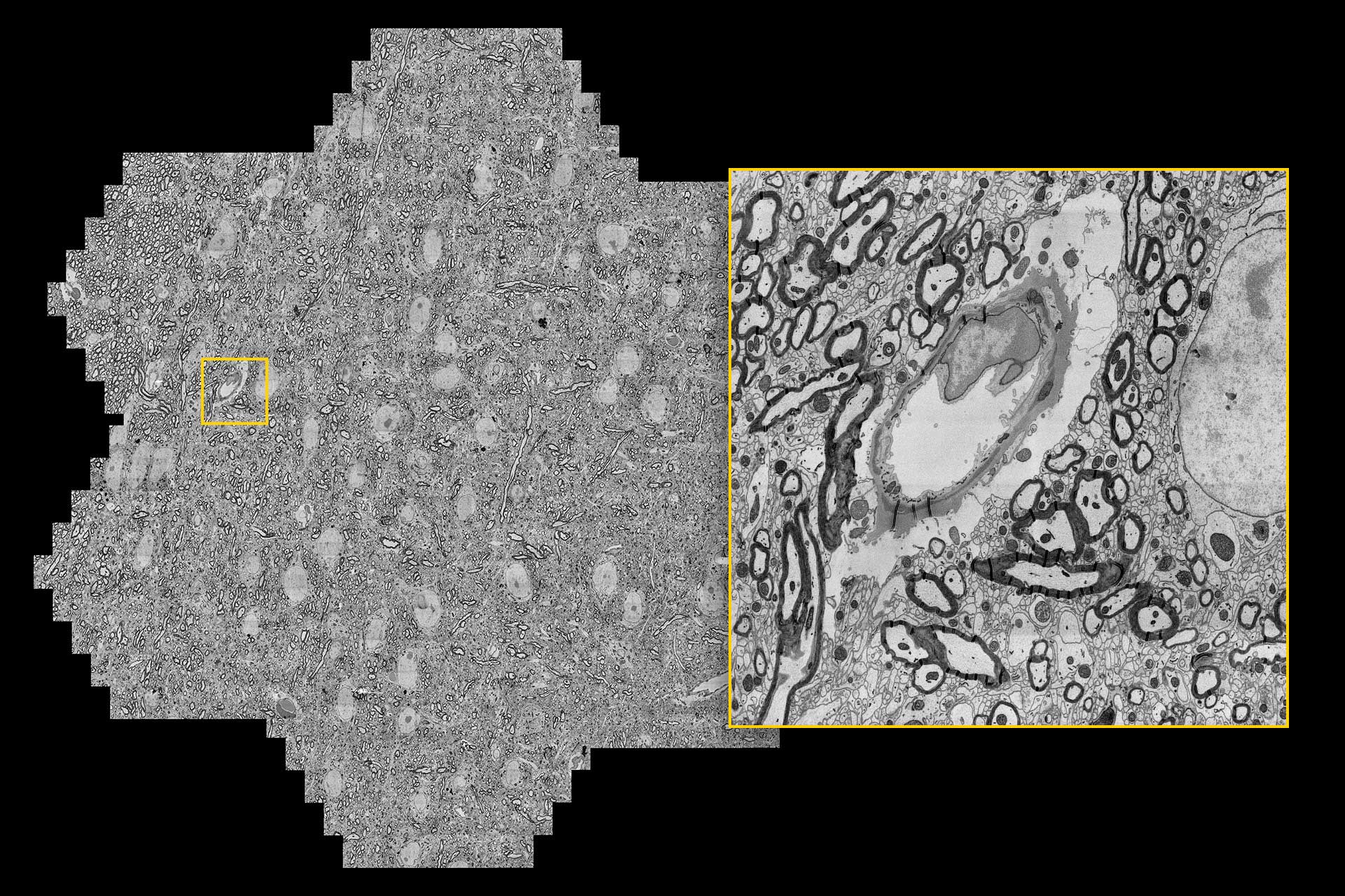 Schnitt durch ein Mäusehirn, maximale Aufnahmegeschwindigkeit 1,22 Gigapixel/Sekunde. 