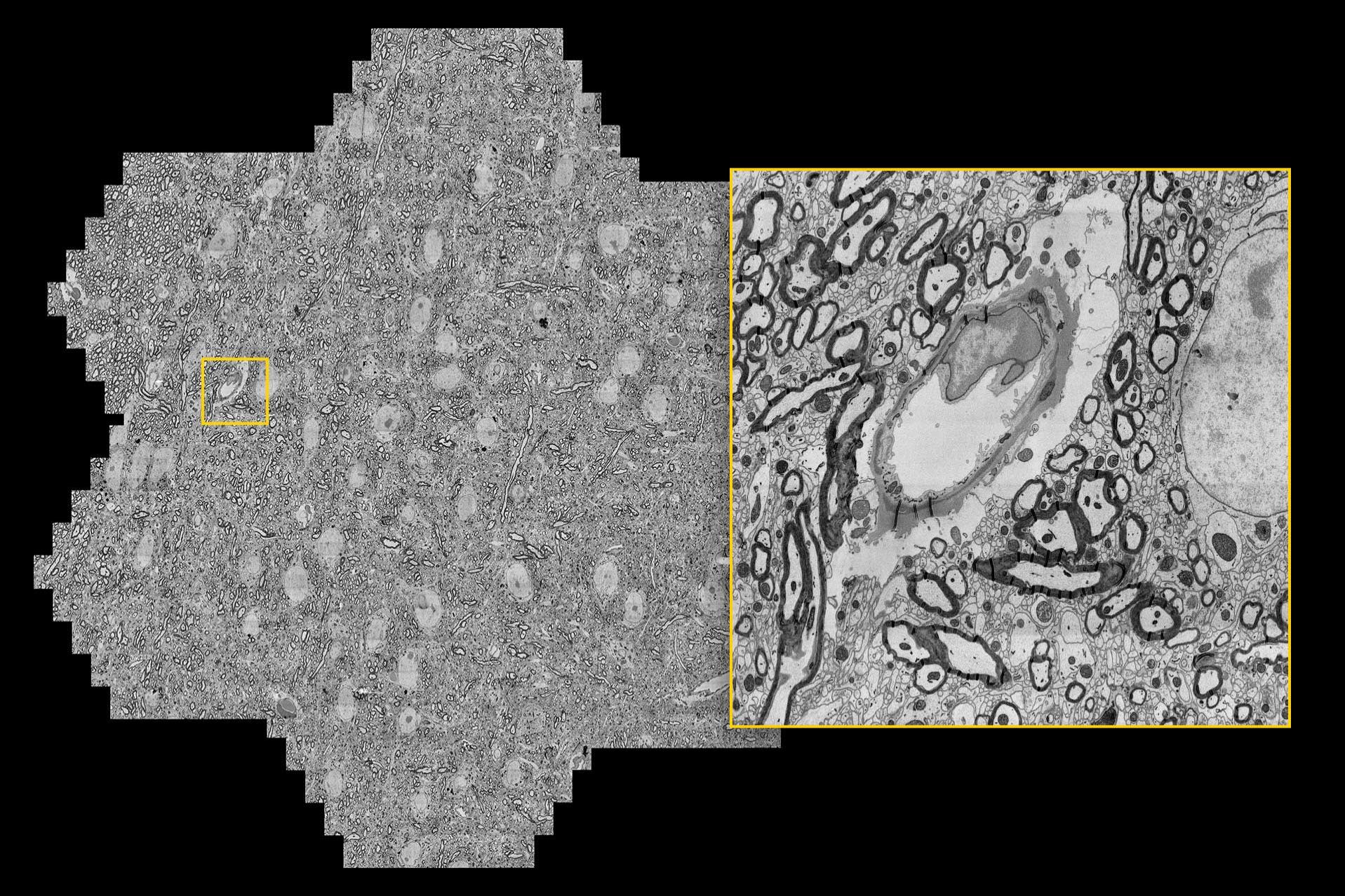 Mouse brain section, maximum acquisition speed of 1.22 gigapixels/second. 