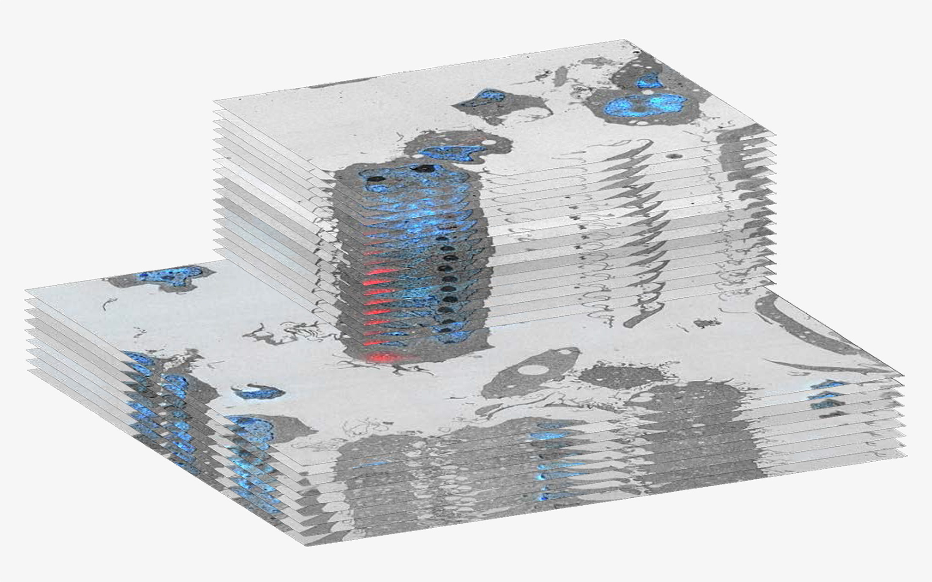 La correlación del Z-stack del microscopio óptico con el Z-stack del microscopio electrónico de barrido muestra la distribución de las placas de huntingtina y la localización del núcleo en 3D