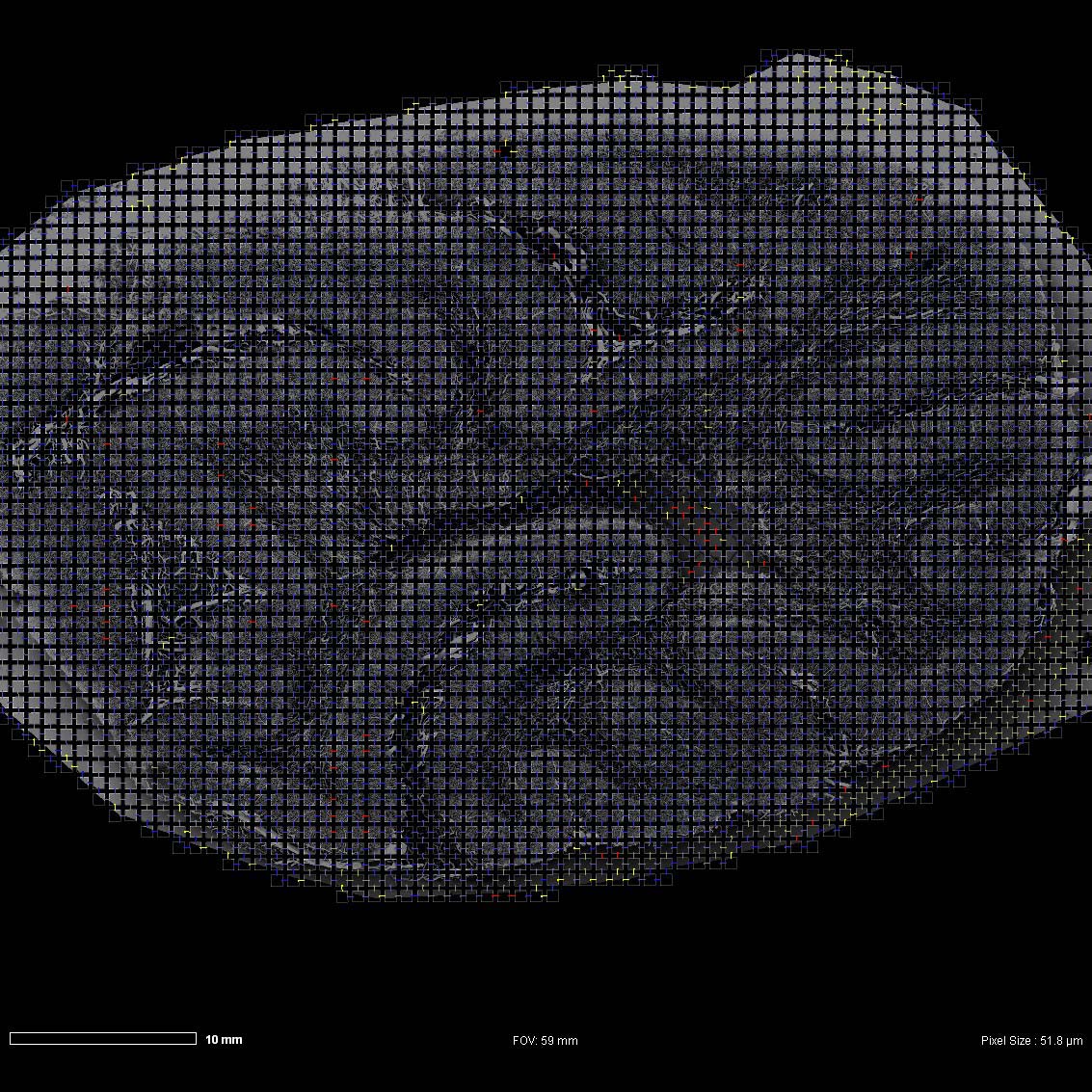 自动拍摄的猴脑样品的大图，显示大脑血管。图像使用Atlas 5 Array Tomography采集。观察视野：3700 mm。
