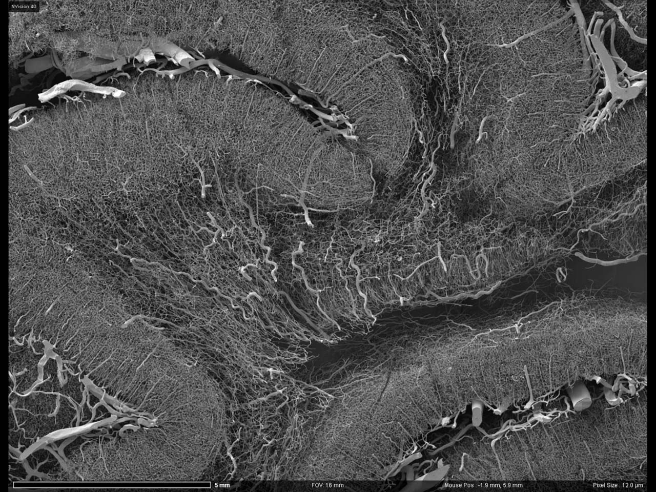Monkey brain vasculature captured using AT.