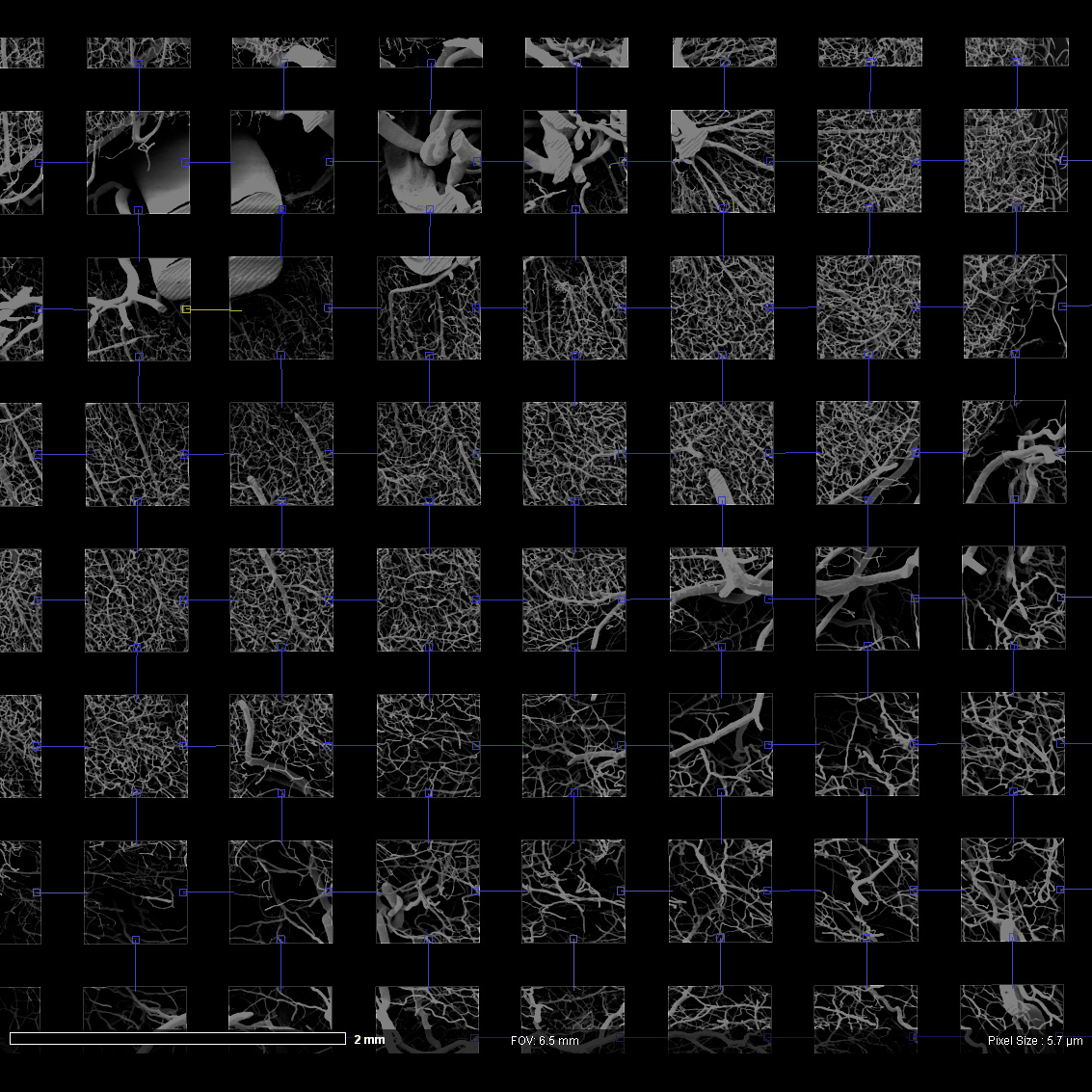 Automated stitching of these tile images to calculate one image of the monkey brain with a large field of view.