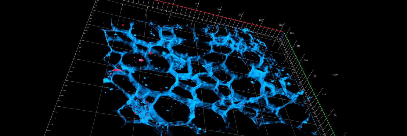 3D reconstruction of serial sections from root nodules with the distribution of plasmodesmata