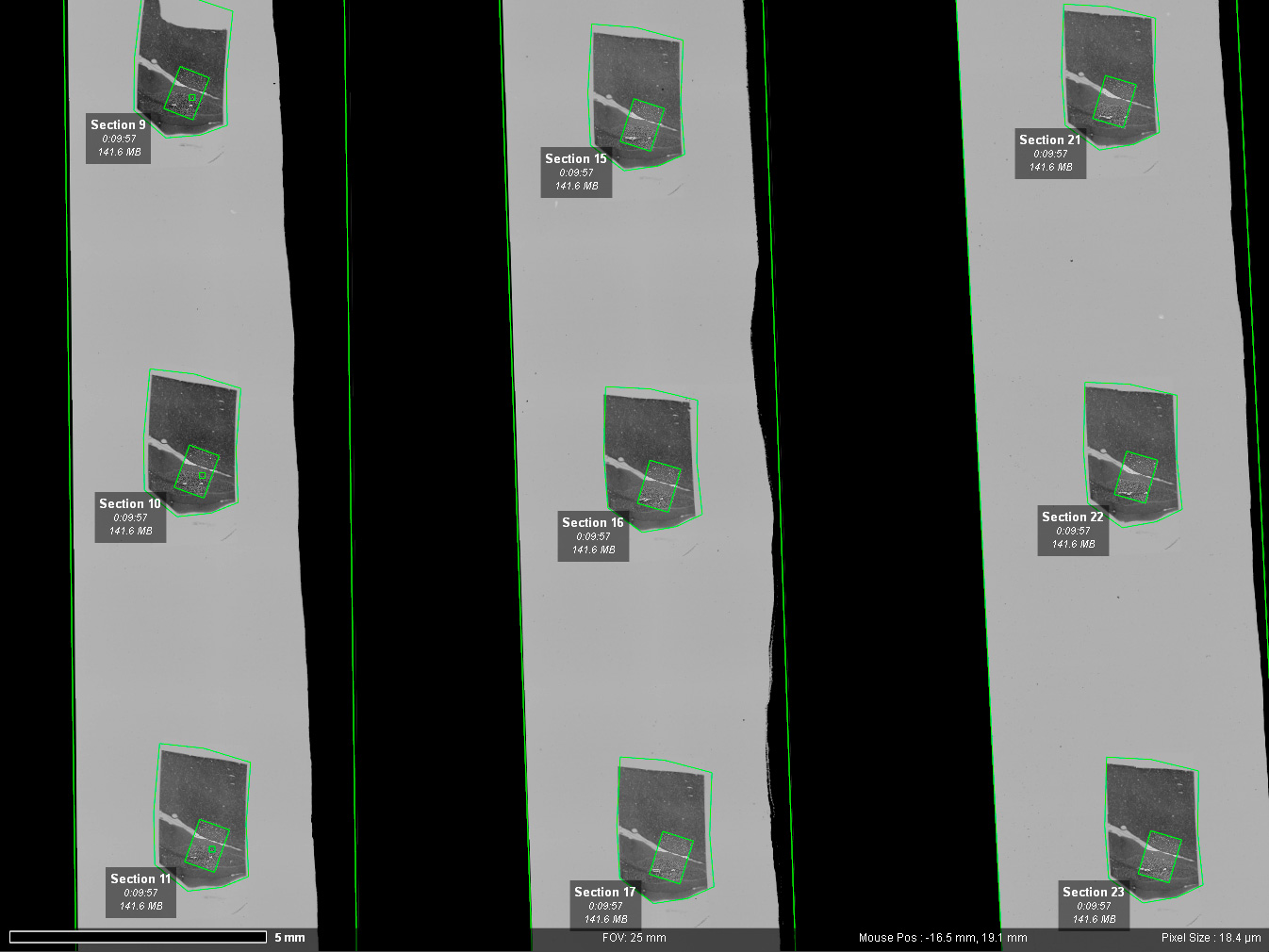 Ultrathin Mouse Brain Section