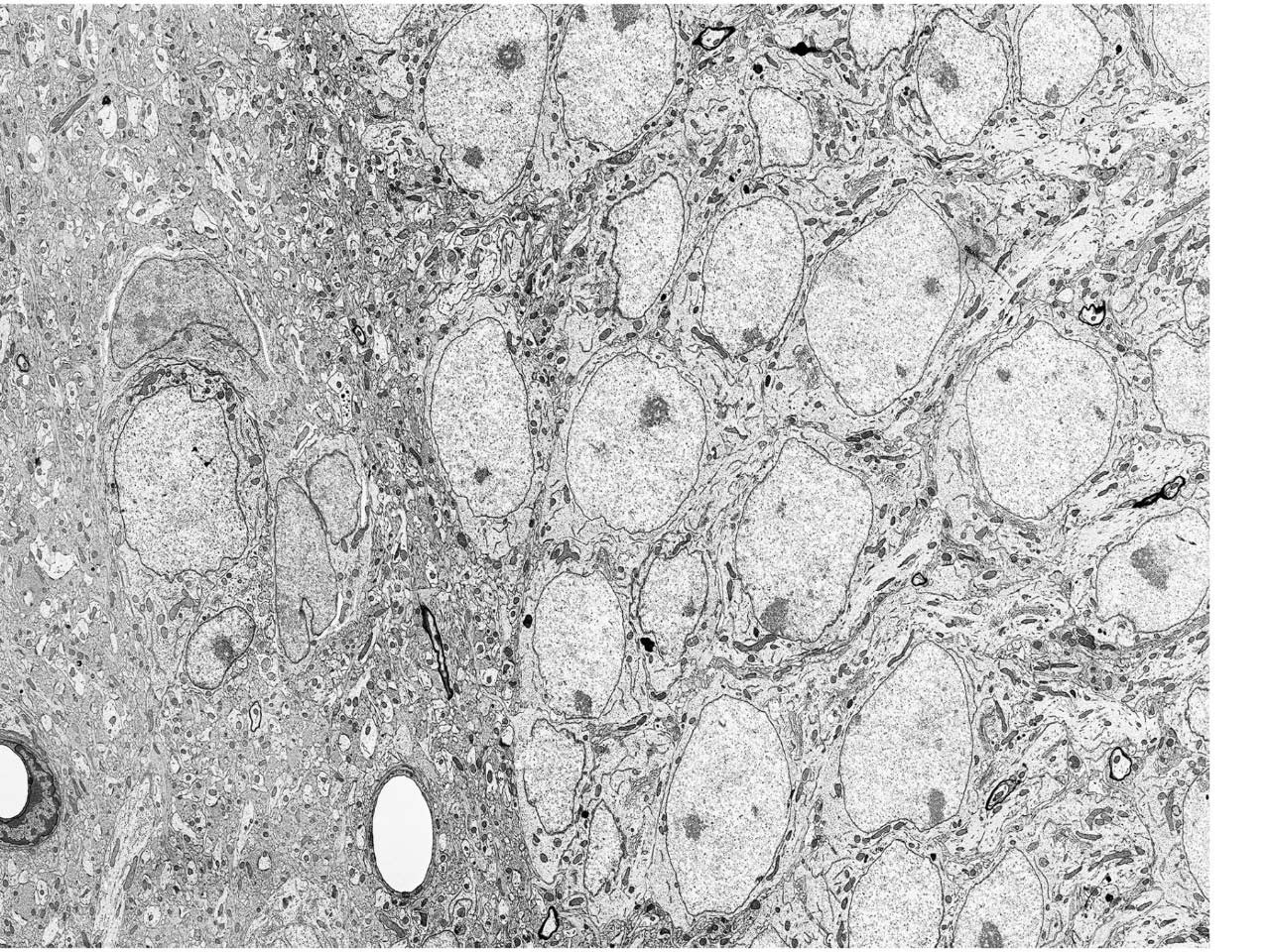 Ultrathin Mouse Brain Section