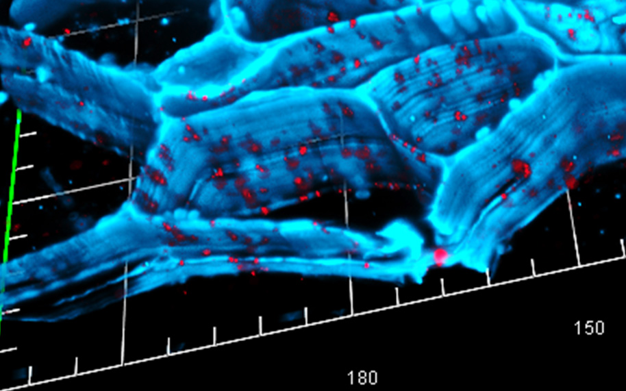Nodules racinaires montrant la distribution des plasmodesmes