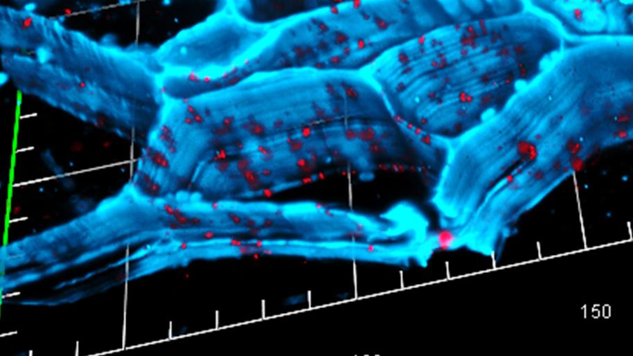 Wurzelknöllchen mit Darstellung der Plasmodesmenverteilung