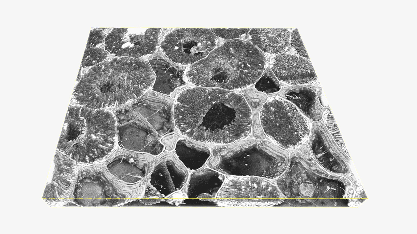 Root Nodules Showing the Distribution of Plasmodesmata