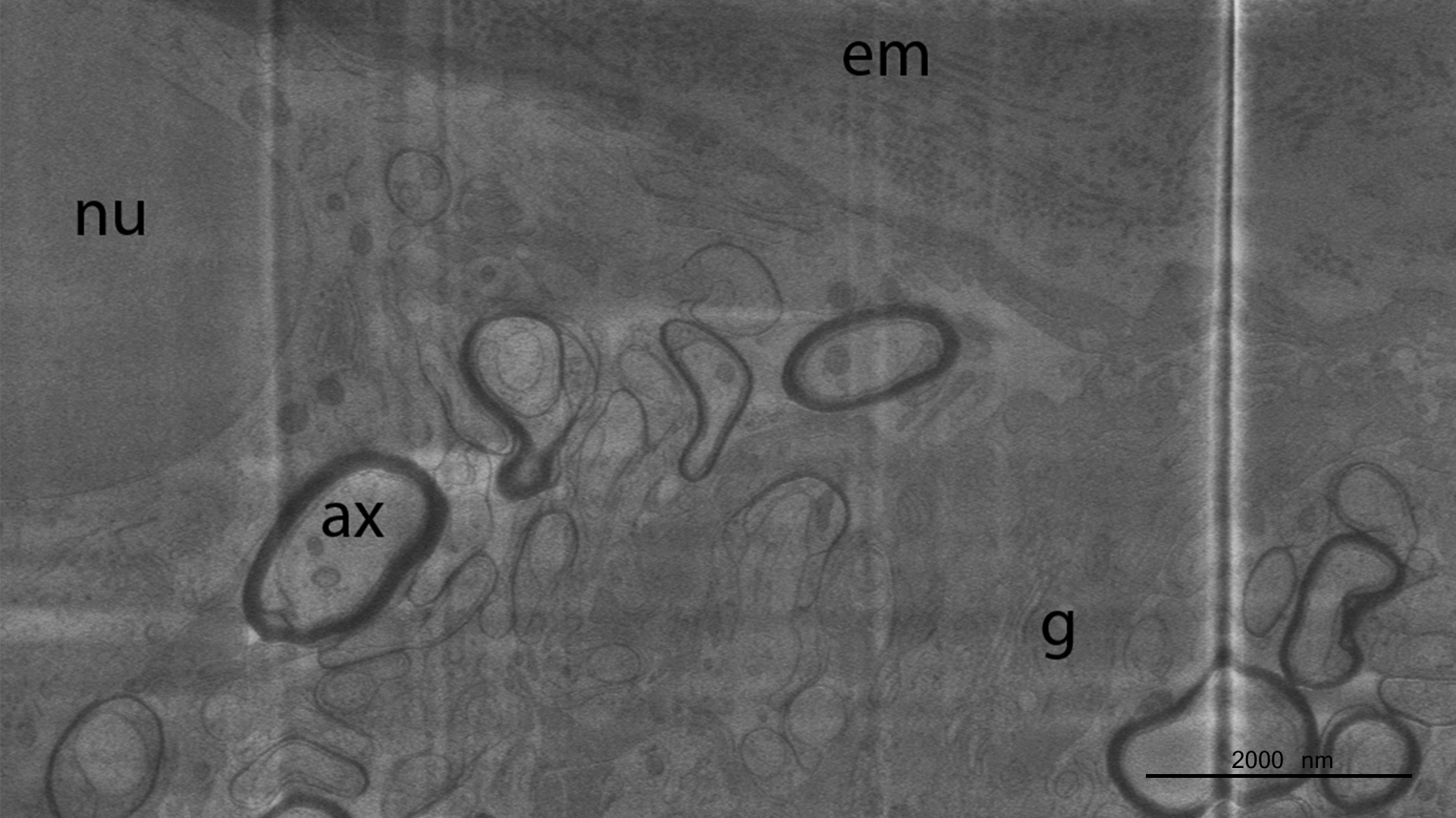 High Pressure Frozen Mouse Optic Nerve at 14 Days