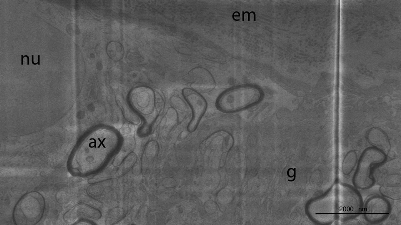 Cryo FIB-SEM | Application Examples