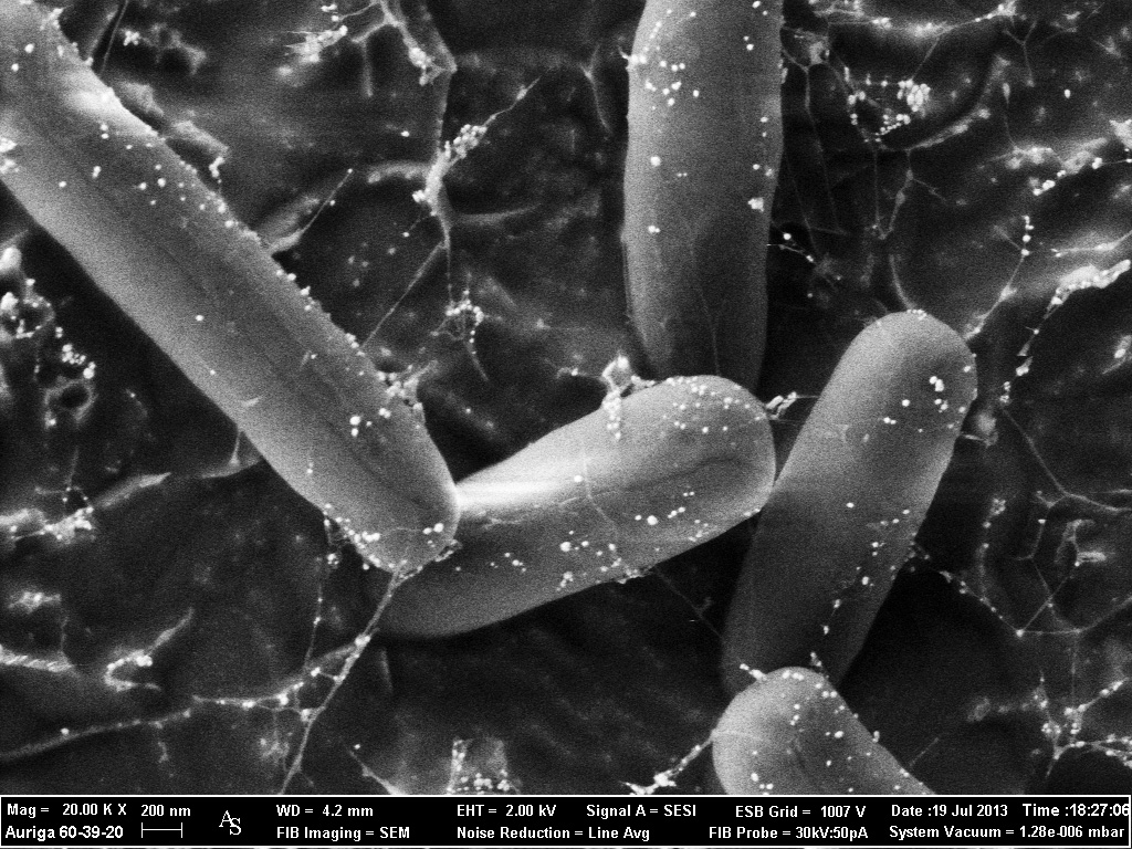 Escherichia coli