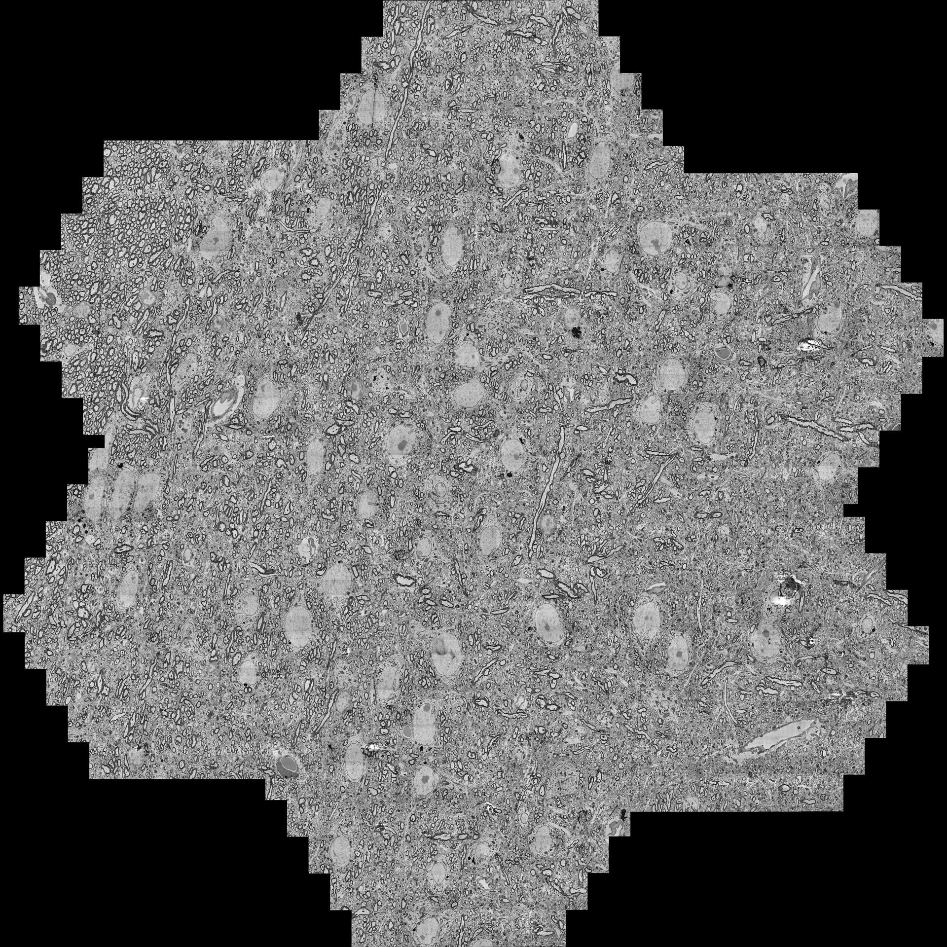 Campos de visión multihaz (mFoV) hexagonales individuales reunidos mediante un conjunto ejemplar de siete mFoV tomados del conjunto de datos anterior. 