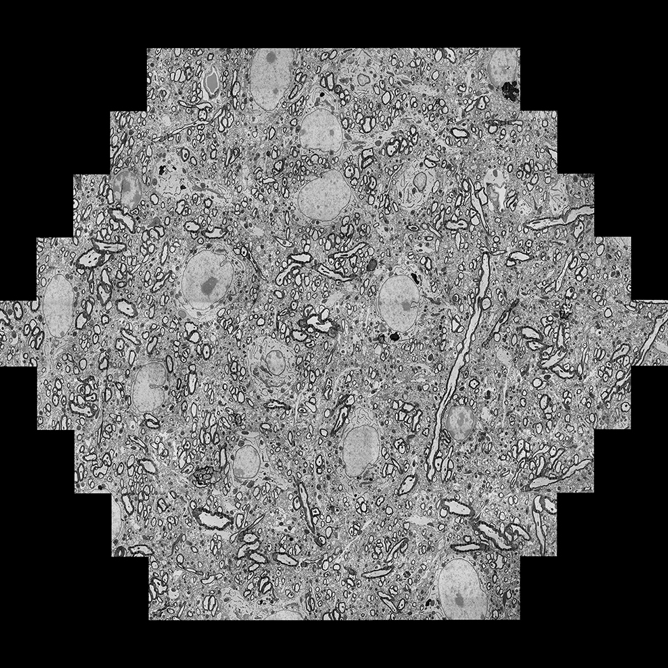 Ejemplo de un solo mFoV, compuesto por 61 mosaicos de imágenes individuales adquiridas con 61 haces de electrones en paralelo, que cubren más de 100 µm de izquierda a derecha, generalmente adquiridas en solo unos segundos.