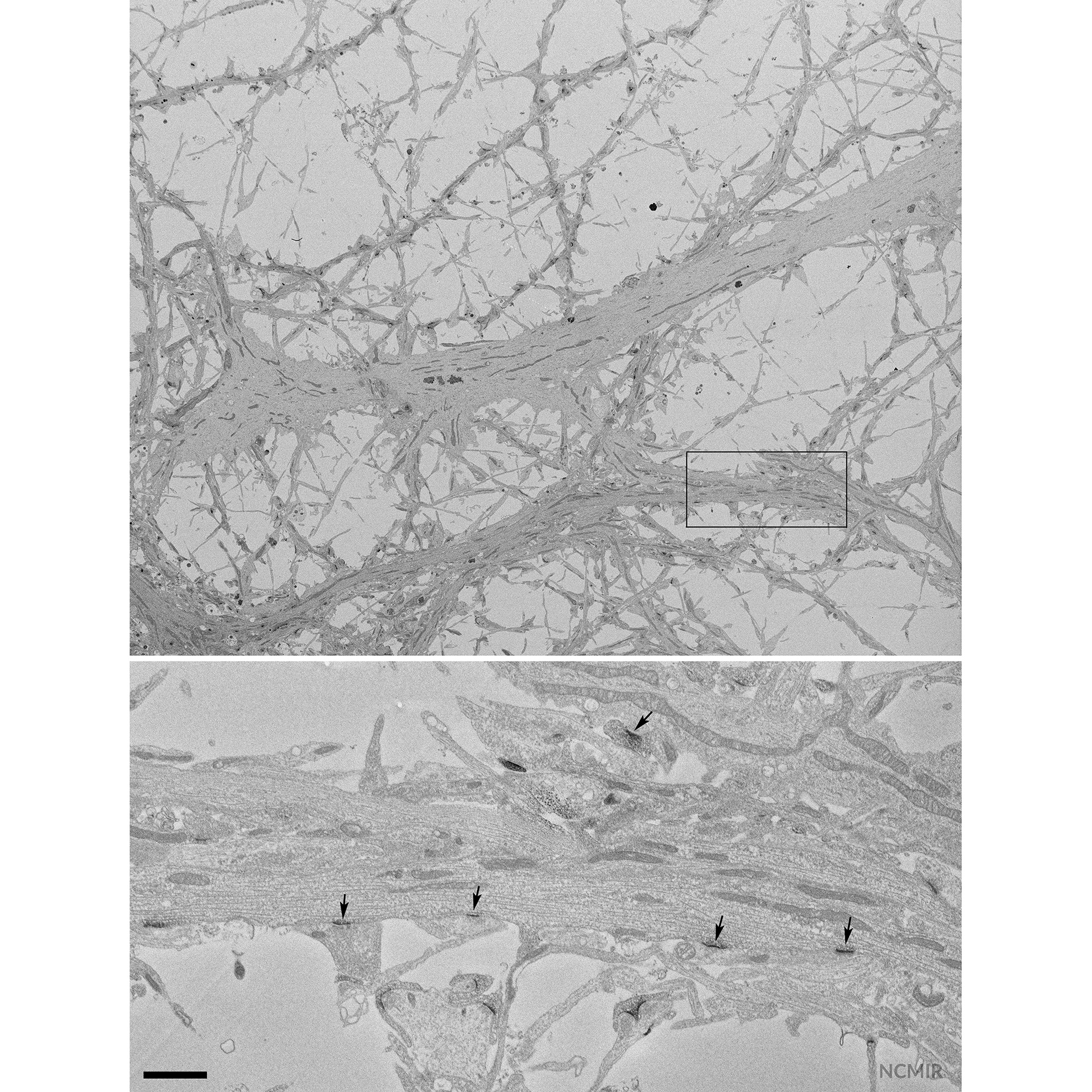 Cerebro de ratón (cultivo de neuronas del hipocampo que expresan PSD95-APEX2 para teñir las densidades postsinápticas)
