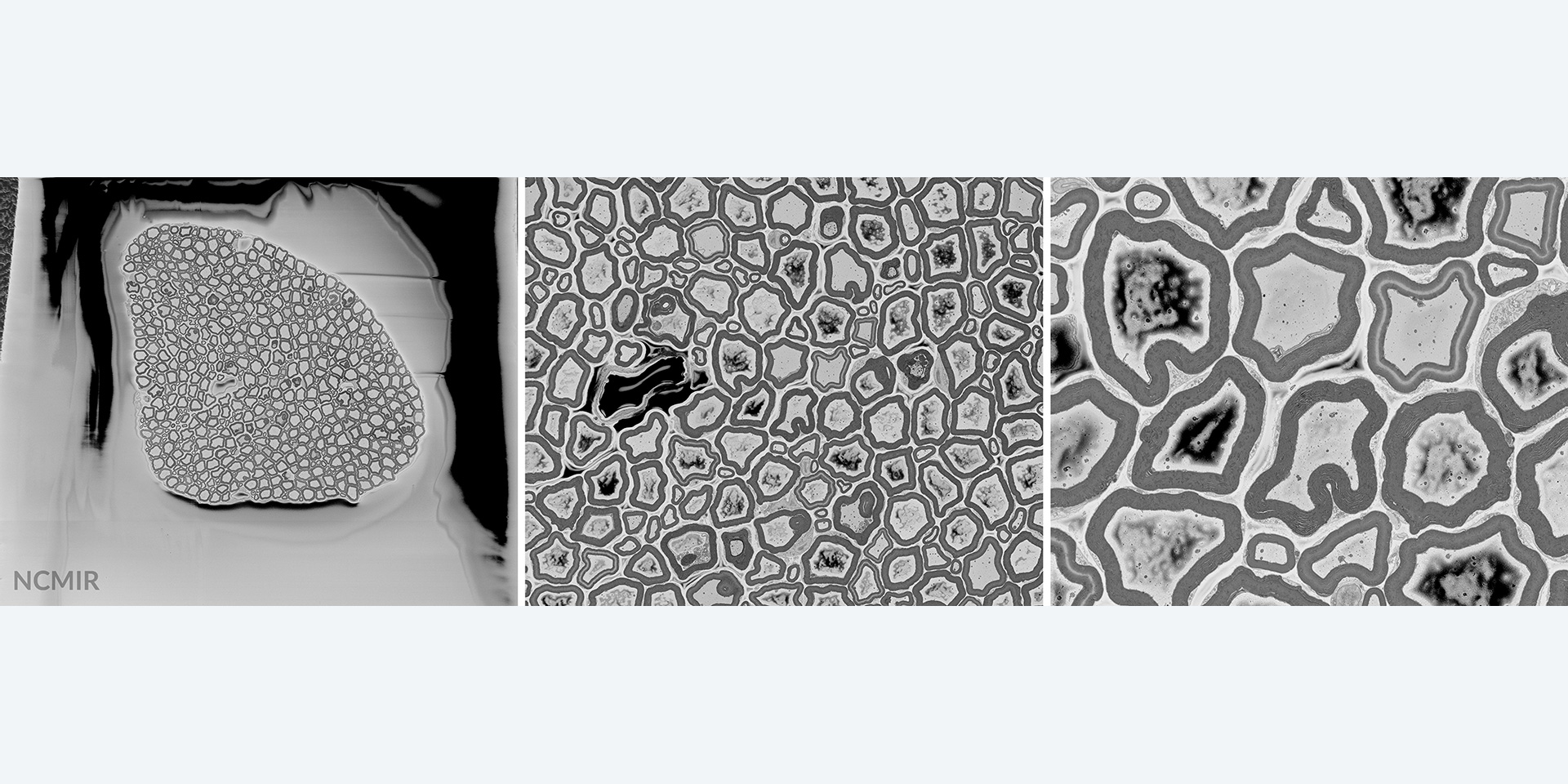 Axonbündel einer Ratte, abgebildet mit Hochvakuum-SEM ohne Focal Charge Compensation. Aufladungseffekte sind deutlich sichtbar. Bild mit freundlicher Genehmigung des National Center for Microscopy and Imaging Research (NCMIR), University of California, San Diego, USA.