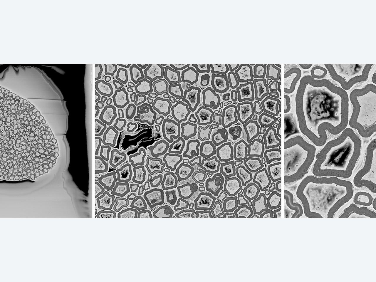 Faisceau d'axones de rat photographié au MEB sous vide poussé sans Focal Charge Compensation. Les effets de charge sont clairement visibles. Image reproduite avec l'aimable autorisation du Centre national de recherche sur la microscopie et l'imagerie (NCMIR), université de Californie, San Diego, États-Unis.