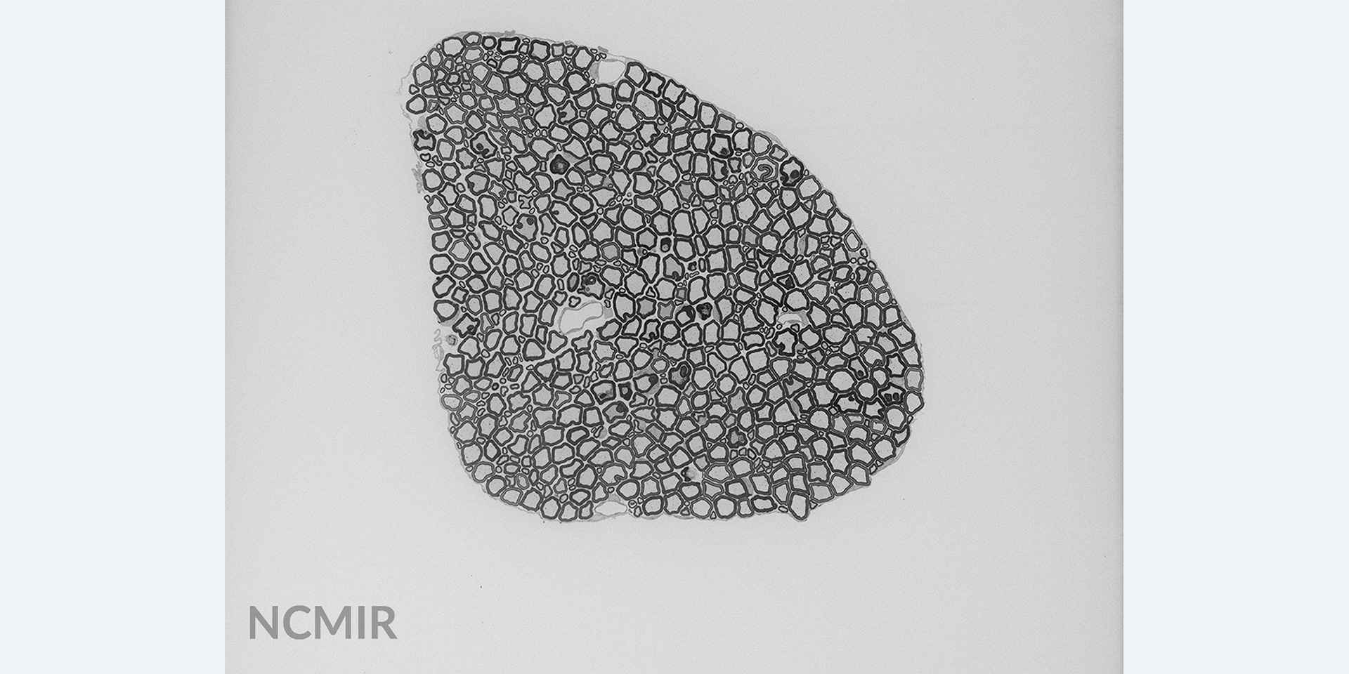 Axonbündel einer Ratte, abgebildet mit Hochvakuum-SEM mit Focal Charge Compensation. Aufladungseffekte sind kaum wahrnehmbar. Bild mit freundlicher Genehmigung des National Center for Microscopy and Imaging Research (NCMIR), University of California, San Diego, USA.