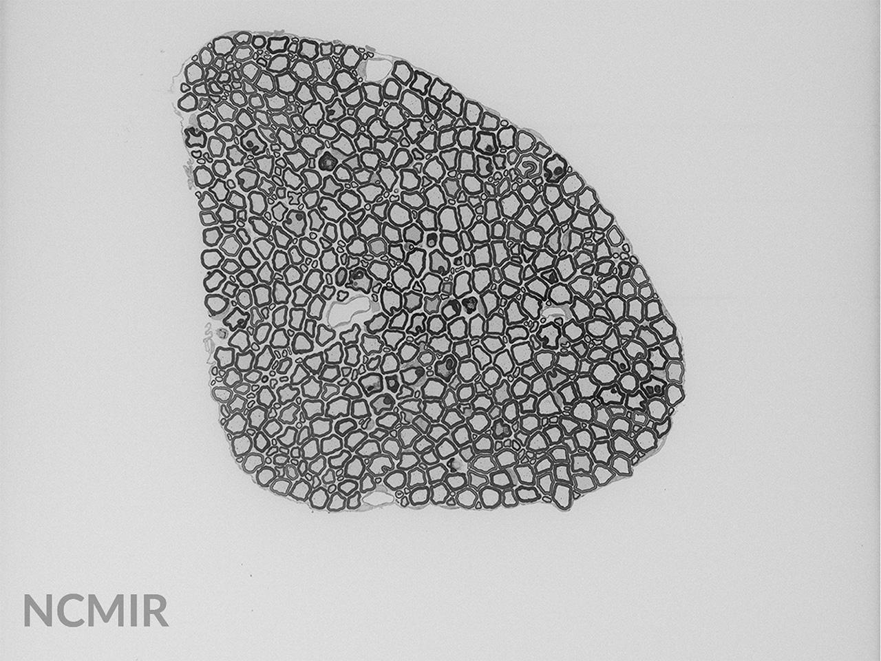 Faisceau d'axones de rat photographié au MEB sous vide poussé avec Focal Charge Compensation. Les effets de charge sont minimisés. Image reproduite avec l'aimable autorisation du Centre national de recherche sur la microscopie et l'imagerie (NCMIR), université de Californie, San Diego, États-Unis.