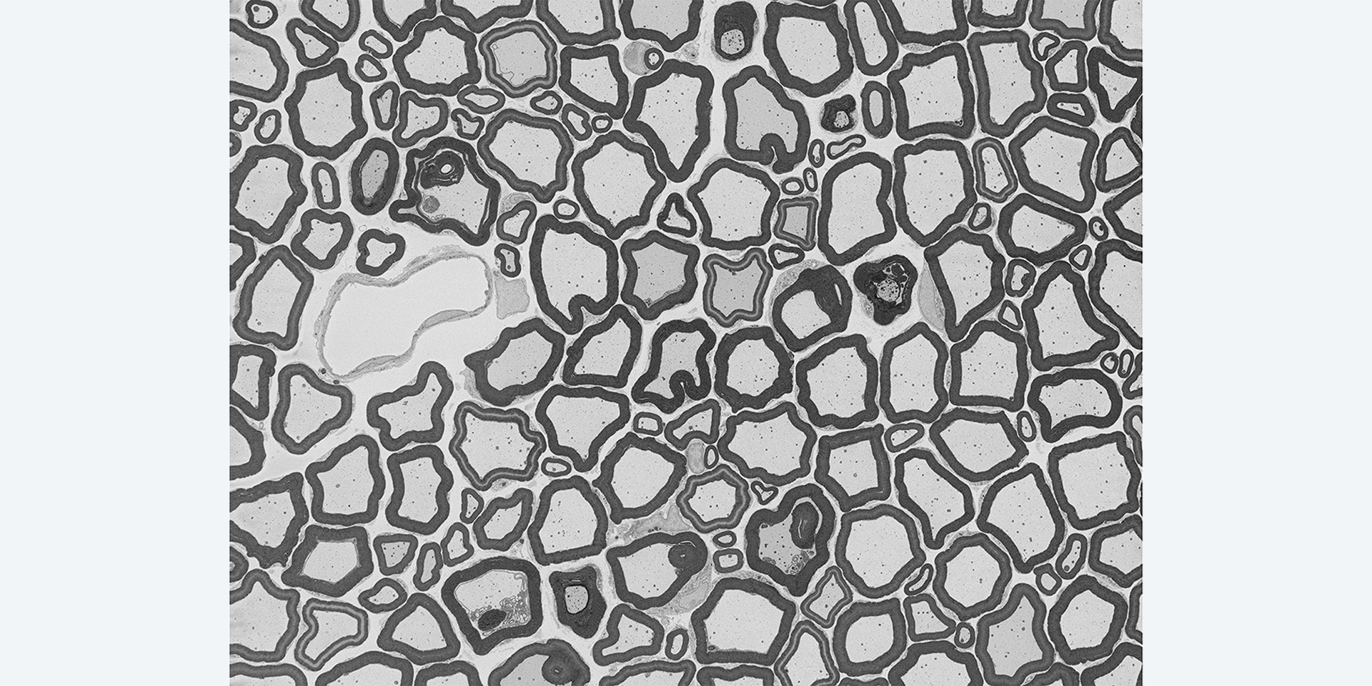 Axonbündel einer Ratte, abgebildet mit Hochvakuum-SEM mit Focal Charge Compensation. Aufladungseffekte sind kaum wahrnehmbar. Bild mit freundlicher Genehmigung des National Center for Microscopy and Imaging Research (NCMIR), University of California, San Diego, USA.