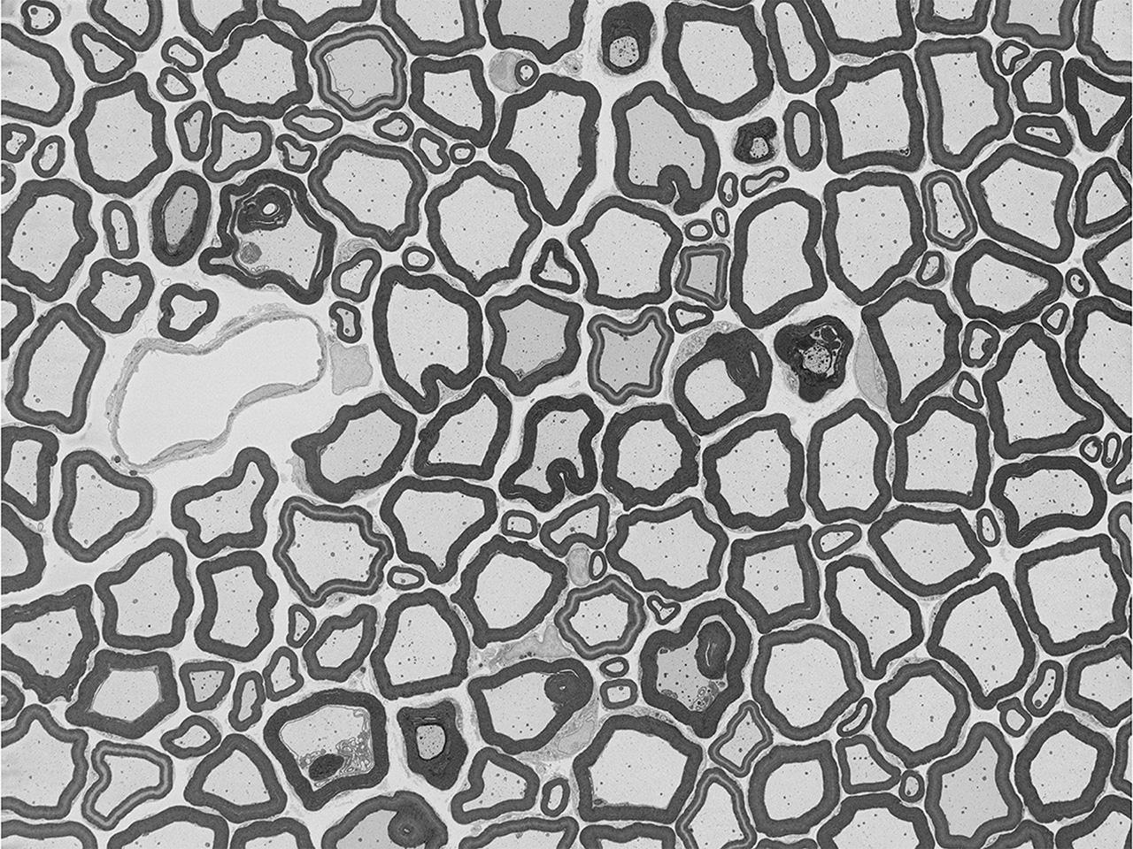 Axonbündel einer Ratte, abgebildet mit Hochvakuum-SEM mit Focal Charge Compensation. Die Aufladungseffekte sind abgeschwächt. Bild mit freundlicher Genehmigung des National Center for Microscopy and Imaging Research (NCMIR), University of California, San Diego, USA.