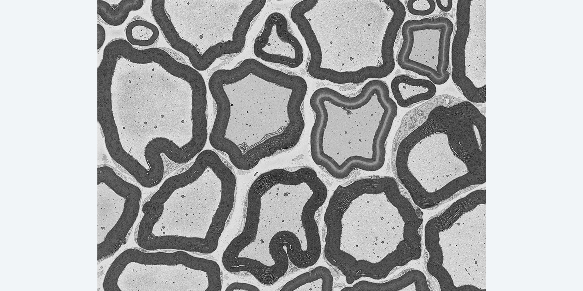 Axonbündel einer Ratte, abgebildet mit Hochvakuum-SEM mit Focal Charge Compensation. Aufladungseffekte sind kaum wahrnehmbar. Bild mit freundlicher Genehmigung des National Center for Microscopy and Imaging Research (NCMIR), University of California, San Diego, USA.