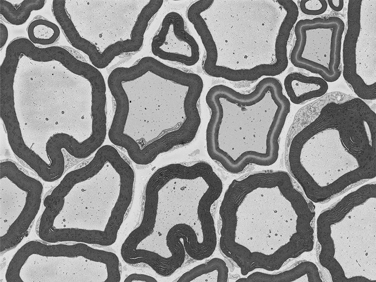 Axonbündel einer Ratte, abgebildet mit Hochvakuum-SEM mit Focal Charge Compensation. Aufladungseffekte sind kaum wahrnehmbar. Bild mit freundlicher Genehmigung des National Center for Microscopy and Imaging Research (NCMIR), University of California, San Diego, USA.