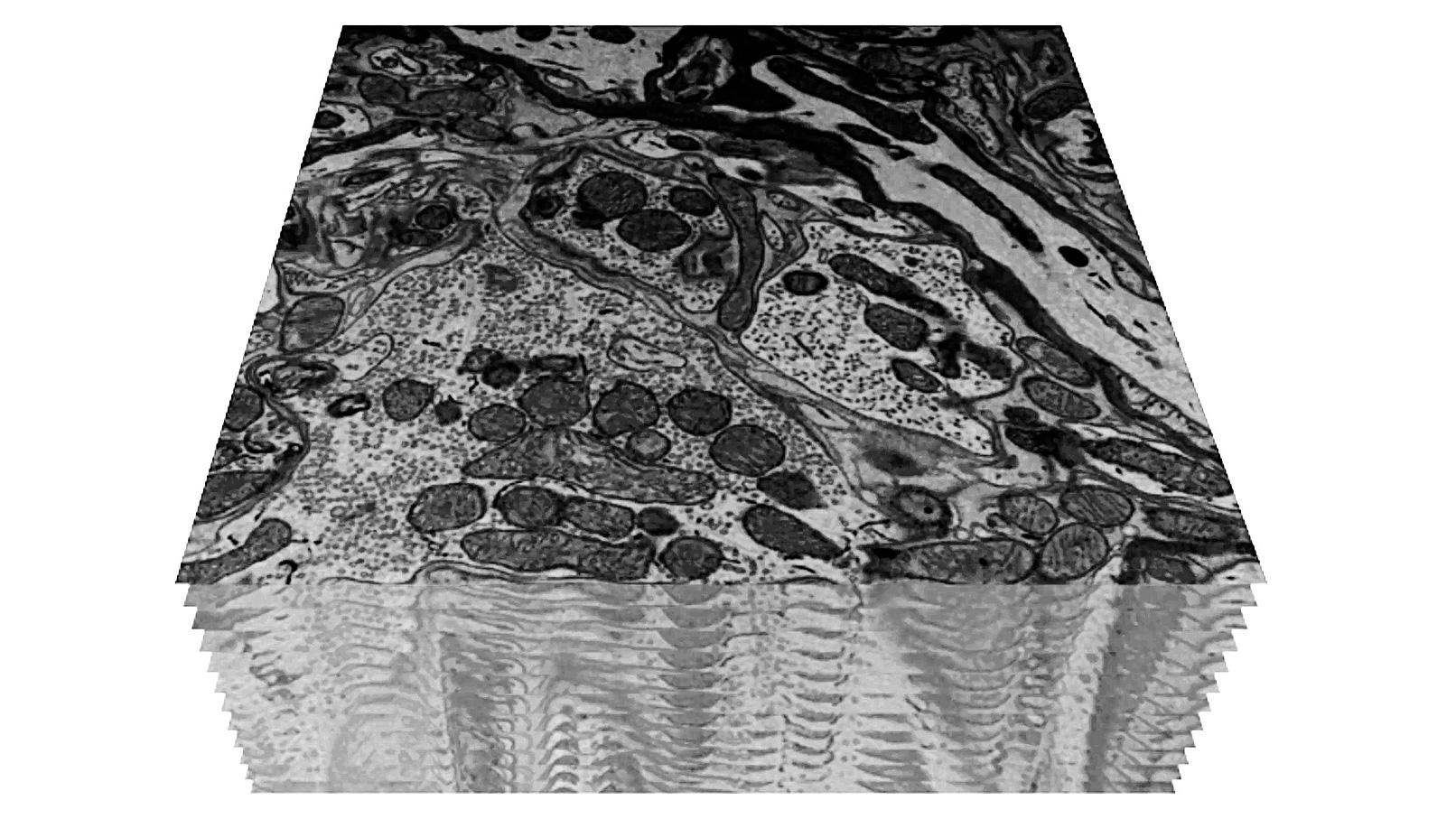 Stack de un cerebro de ratón incluido en resina y luego capturada mediante un detector BSE y un equipo SBF.